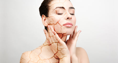 How to treat dry, tight skin