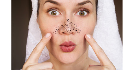 3 Steps to eliminate blackheads