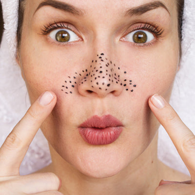 3 Steps to eliminate blackheads