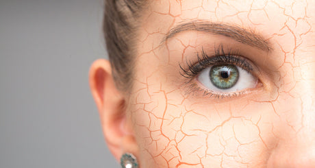 Signs of dehydrated skin and how to treat it