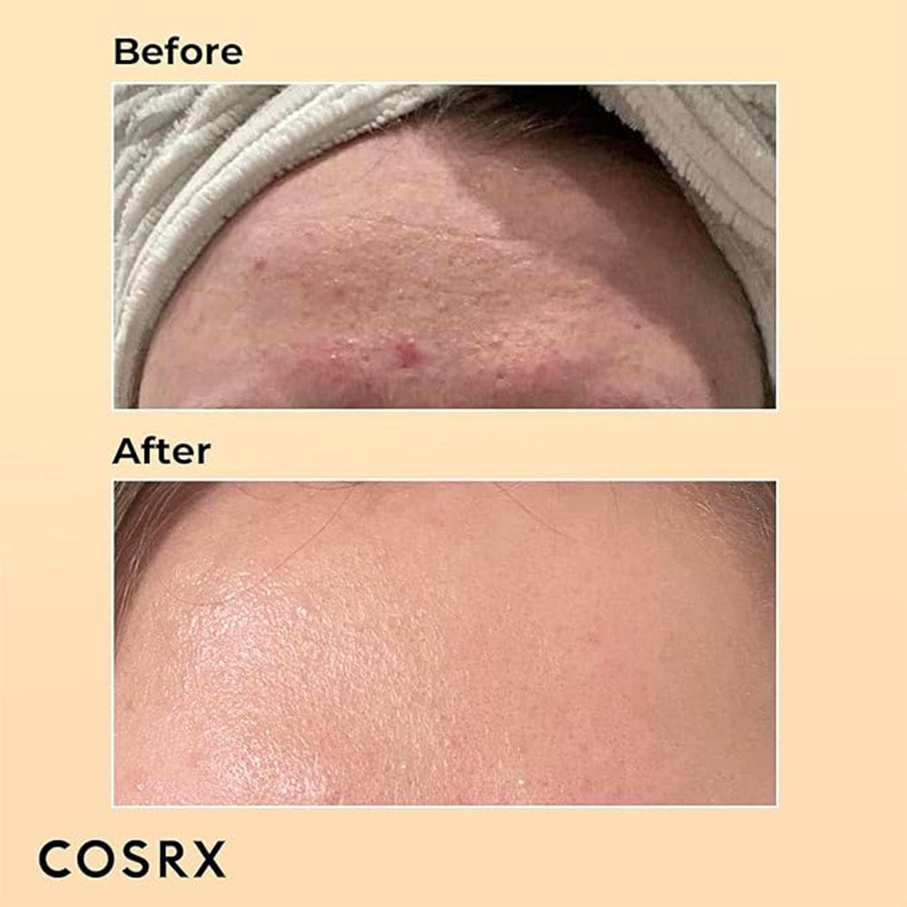 COSRX Serum COSRX Advanced Snail 96 Mucin Power Essence 100ml