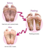 Sole Foot Peel Softsole Exfoliating Foot Peel