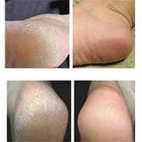 Sole Foot Peel Softsole Exfoliating Foot Peel